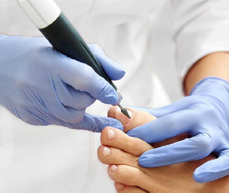 Pédicure Médicale diplômée